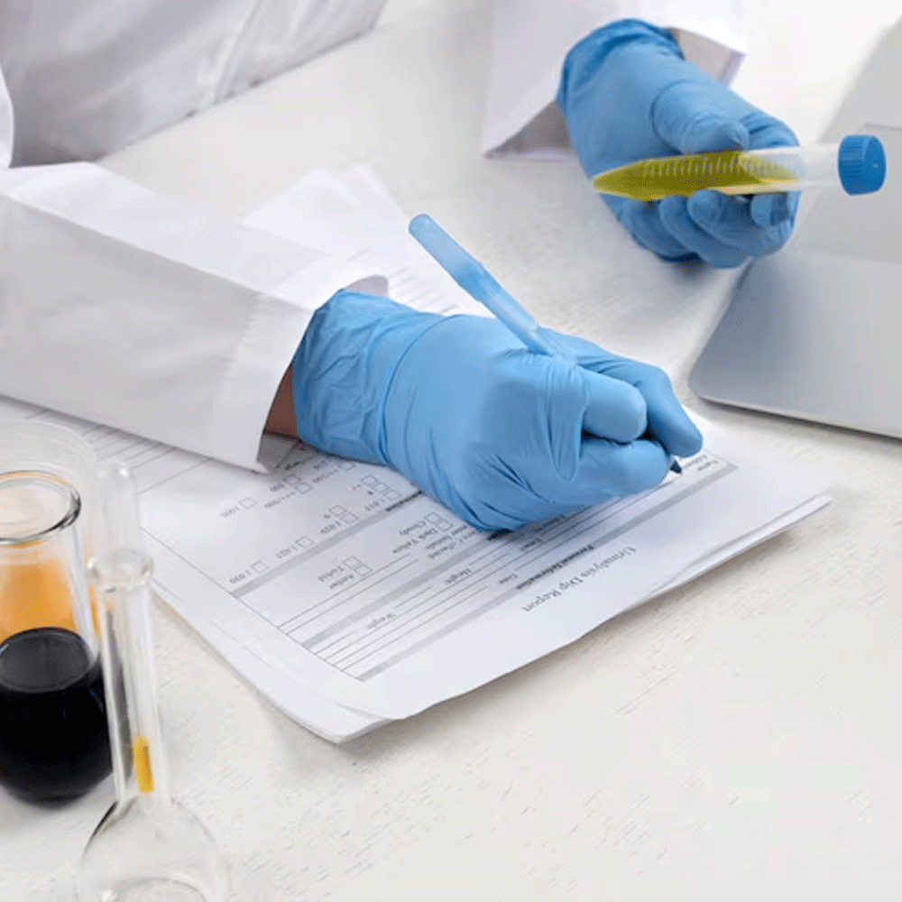 İdrar ve Dışkı Analizleri